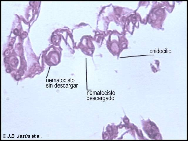 Sección histológica de Hydra sp.