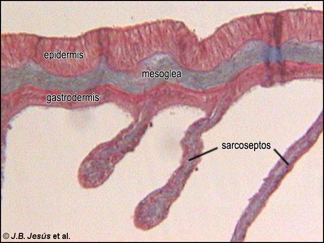 Detalle de la sección transversal de un pólipo hexacoralario solitario