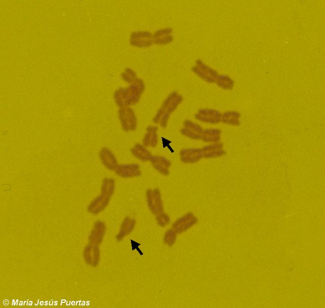 Mitosis de centeno con cromosomas B