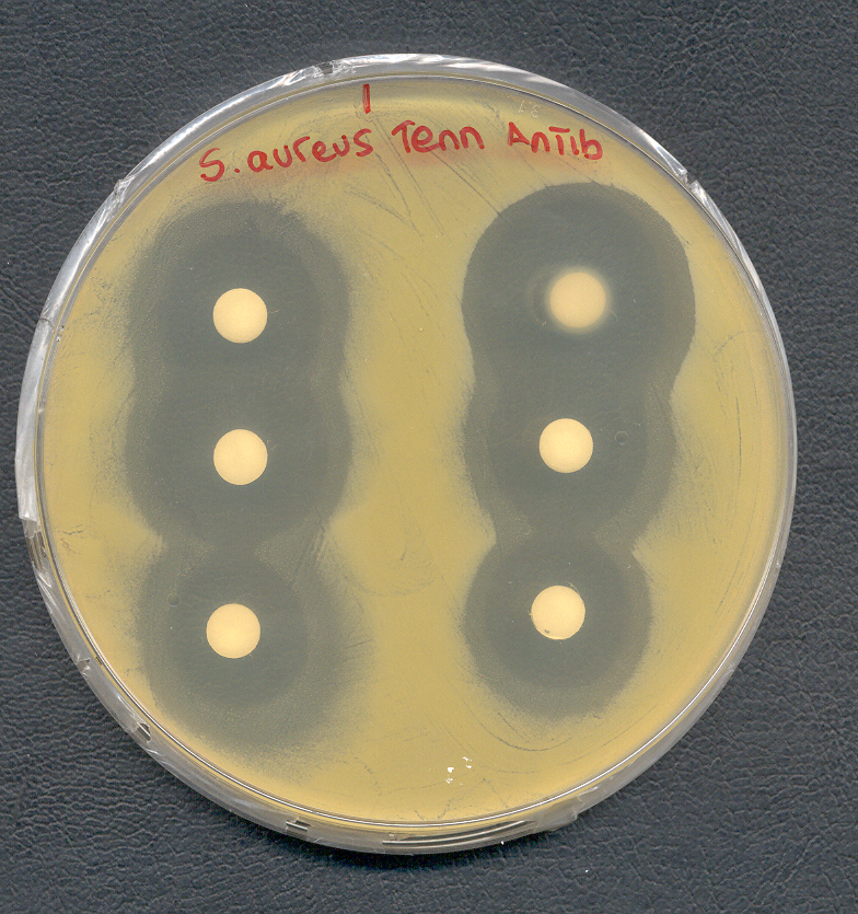 Sensibilidad de Staphylococcus aureus a tenn antibacterias
