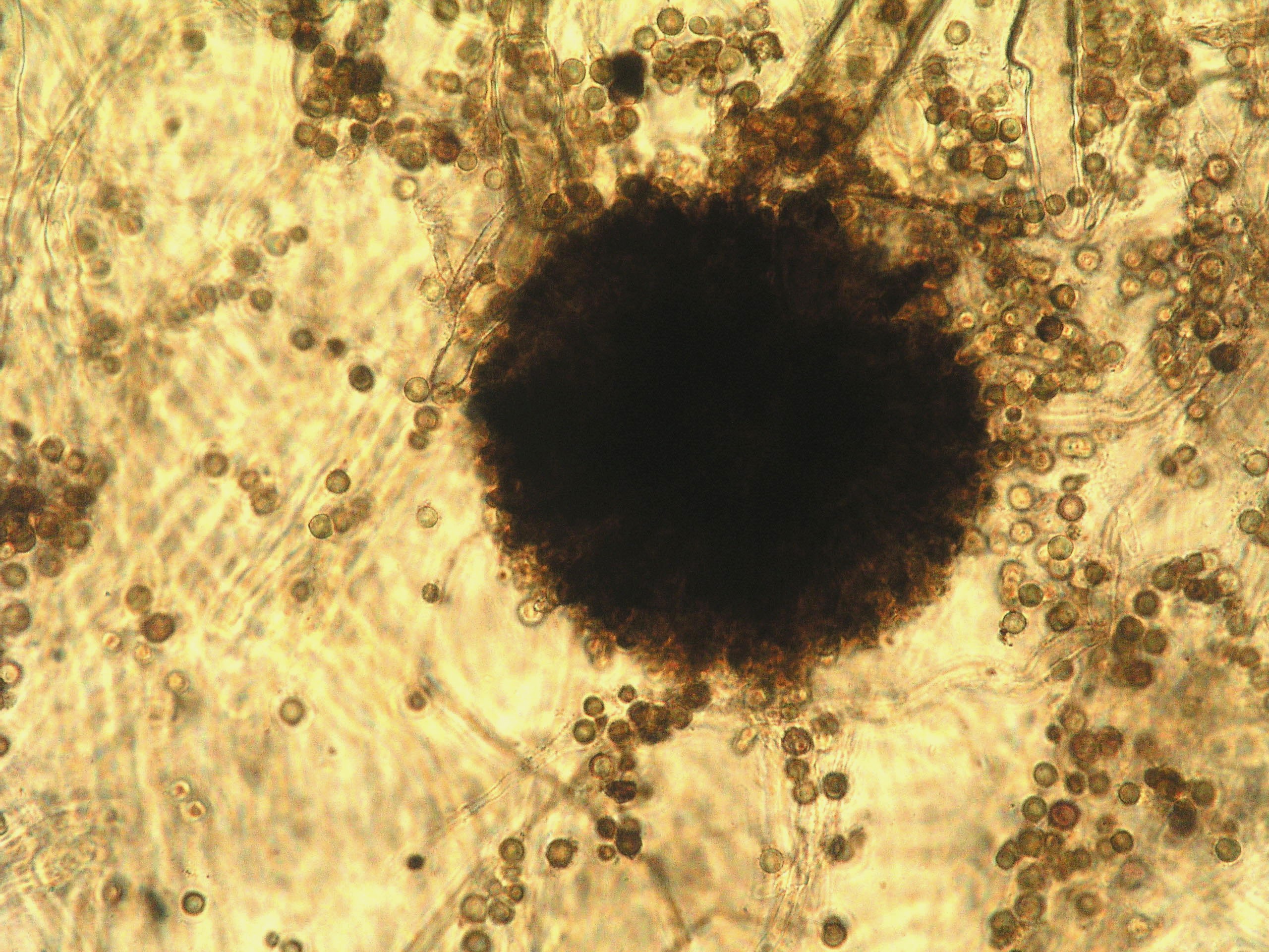 Micrografía de Aspergillus carbonarius
