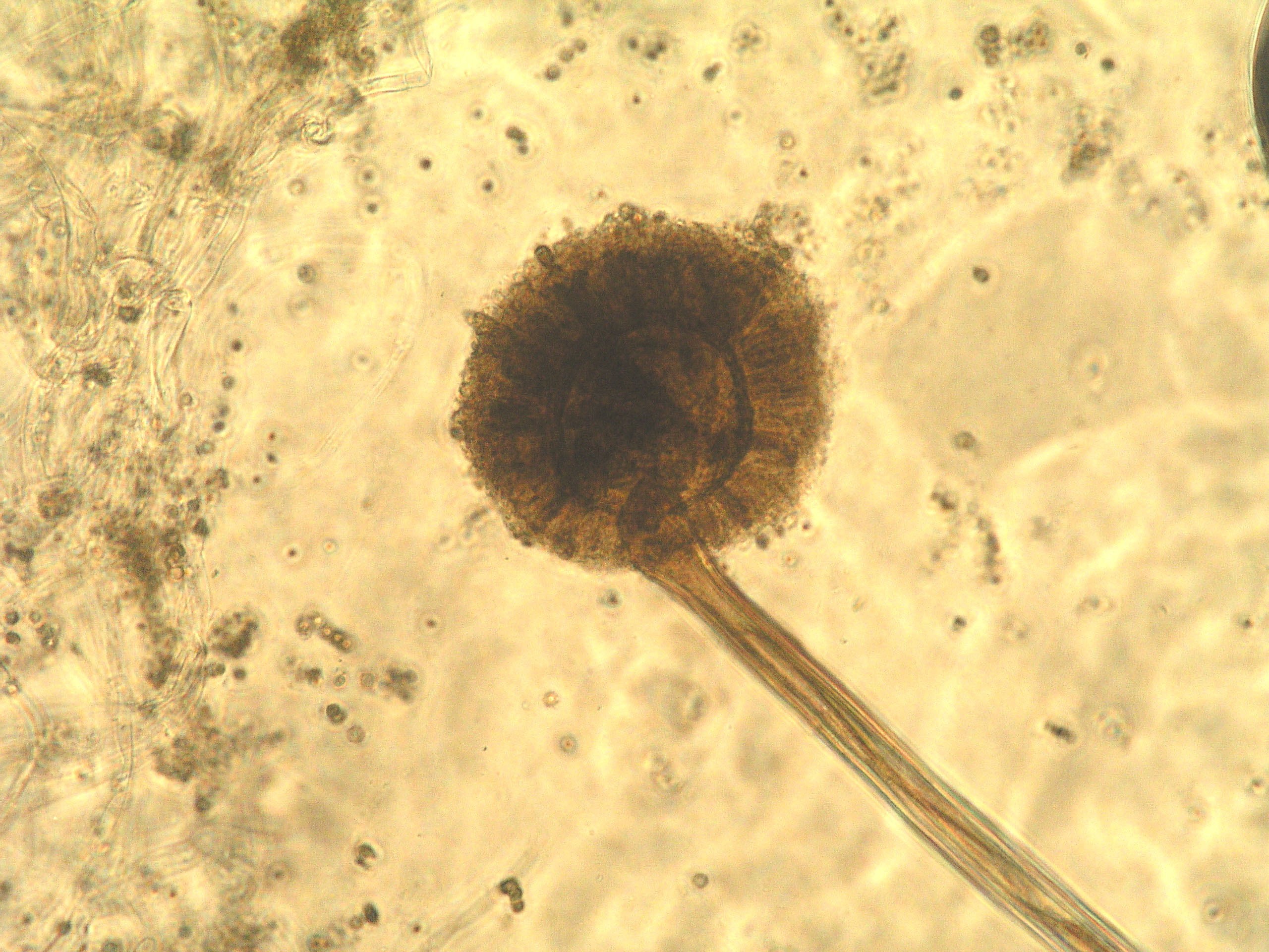 Micrografía de Aspergillus niger