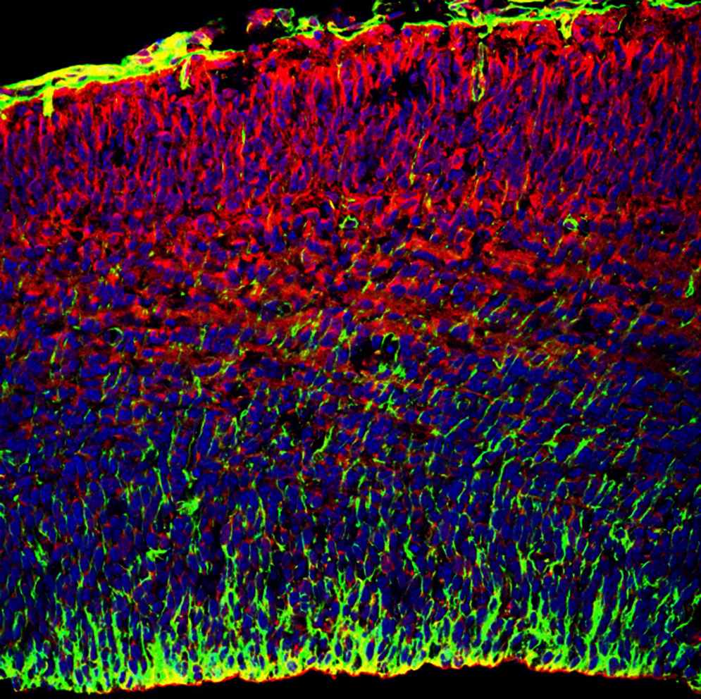 Migracion radial en el neocortex durante el desarrollo