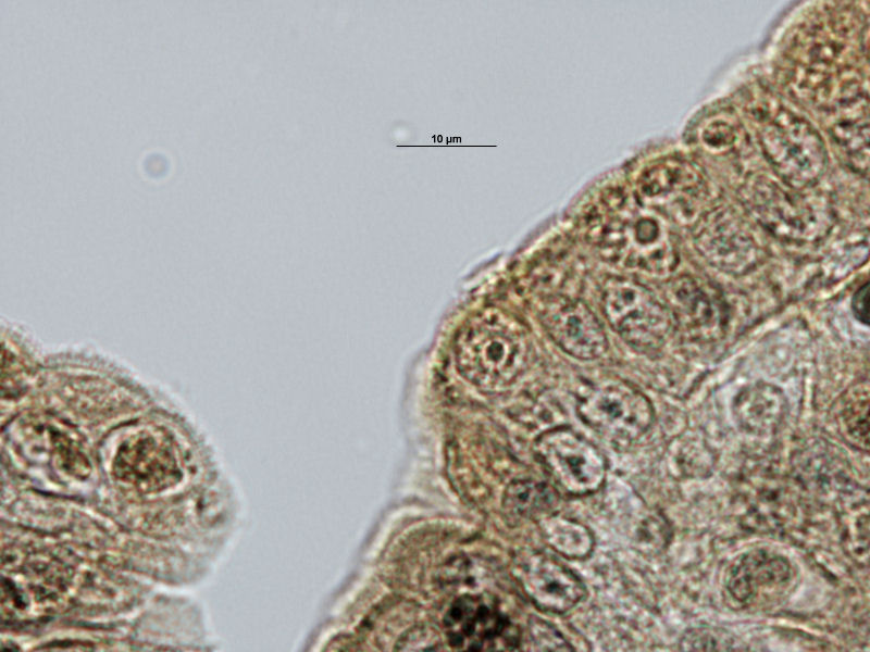 Gametocito femenino de Toxoplasma.