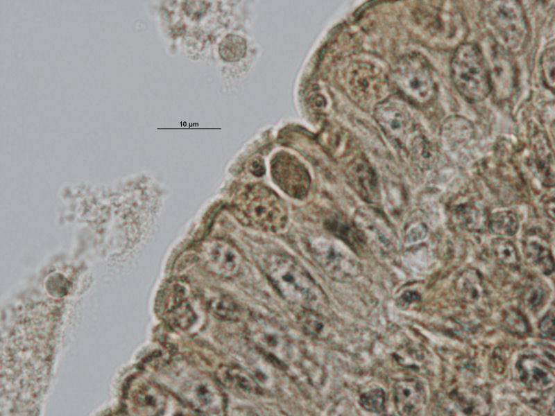Gametocito masculino de Toxoplasma.