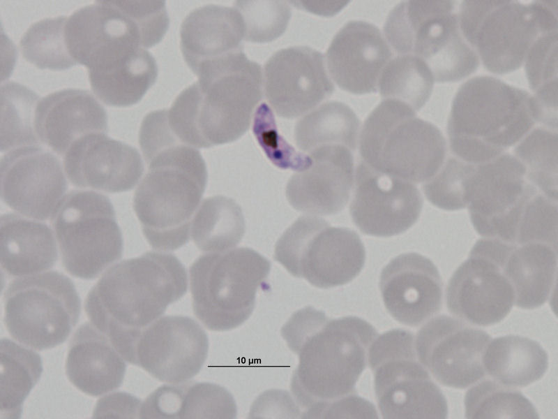 Macrogametocito de Plasmodium falciparum.