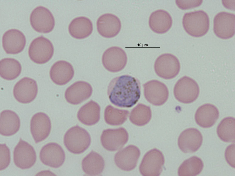 Microgametocito de Plasmodium ovale.