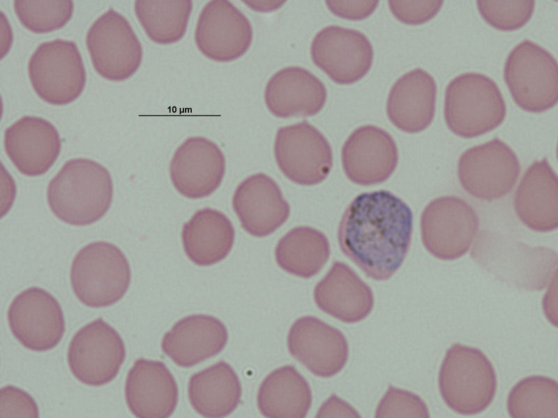Macrogametocito de Plasmodium ovale.
