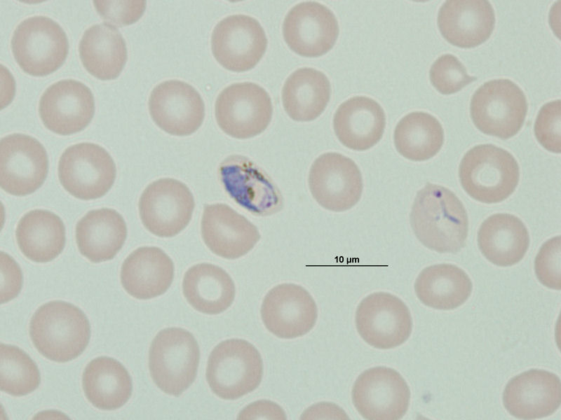 Trofozoíto maduro de Plasmodium vivax.