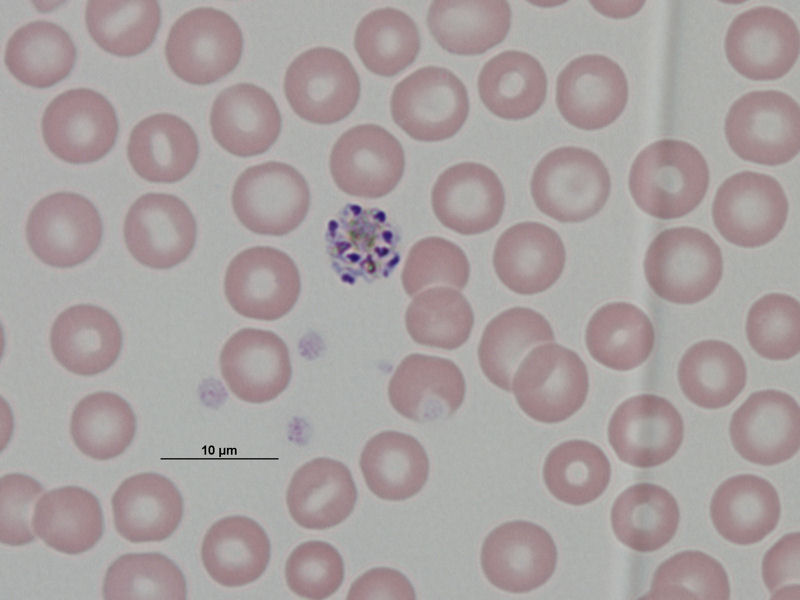 Esquizonte de Plasmodium malariae.