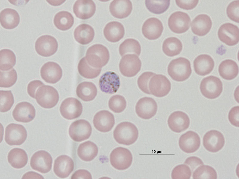 Macrogametocito de Plasmodium malariae.