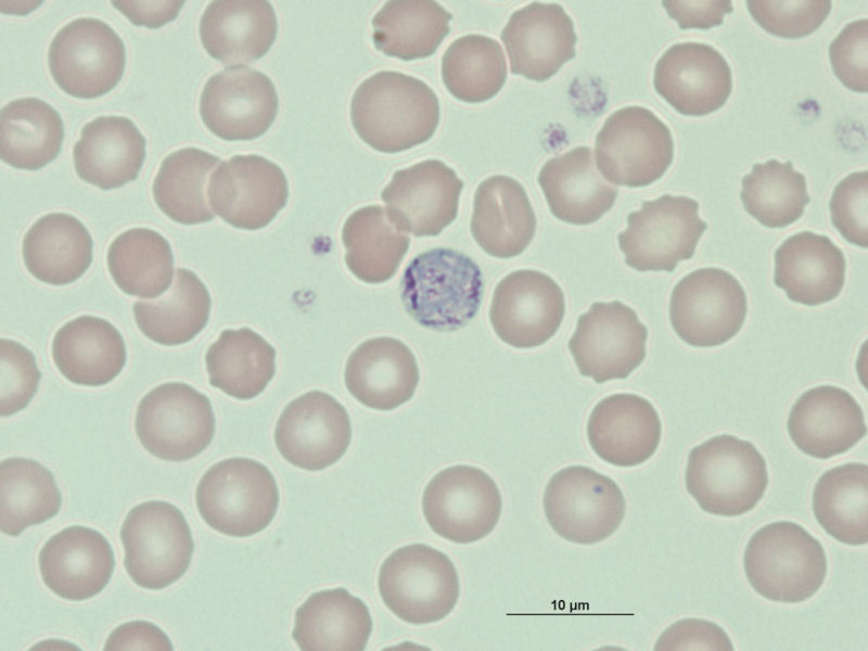 Microgametocito de Plasmodium malariae.