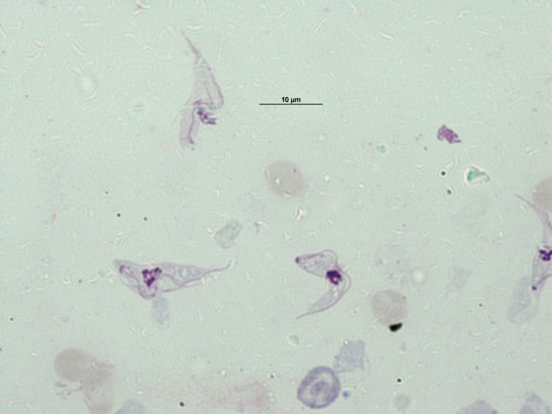 Tripomastigoto de Trypanosoma brucei.