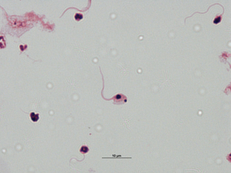 Esferomastigoto  de Trypanosoma cruzi .