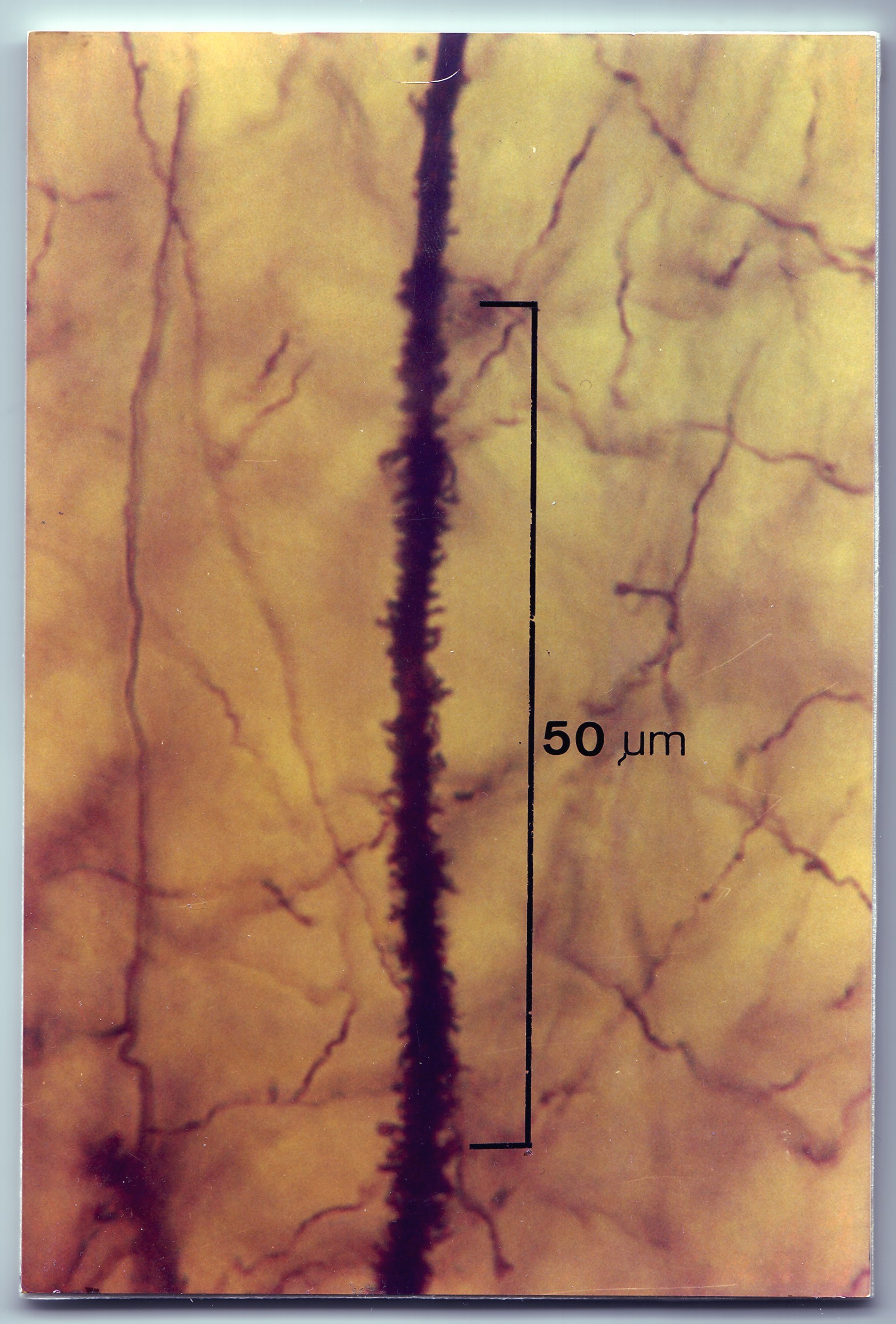 Detalle de la Dendríta Apical de una Neurona Piramidal profunda.