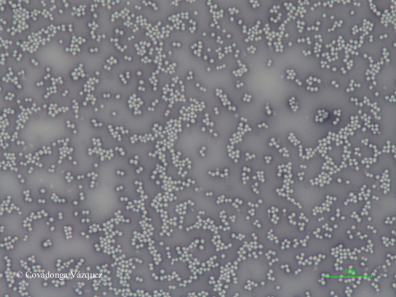 Tinción negativa de Staphylococcus aureus