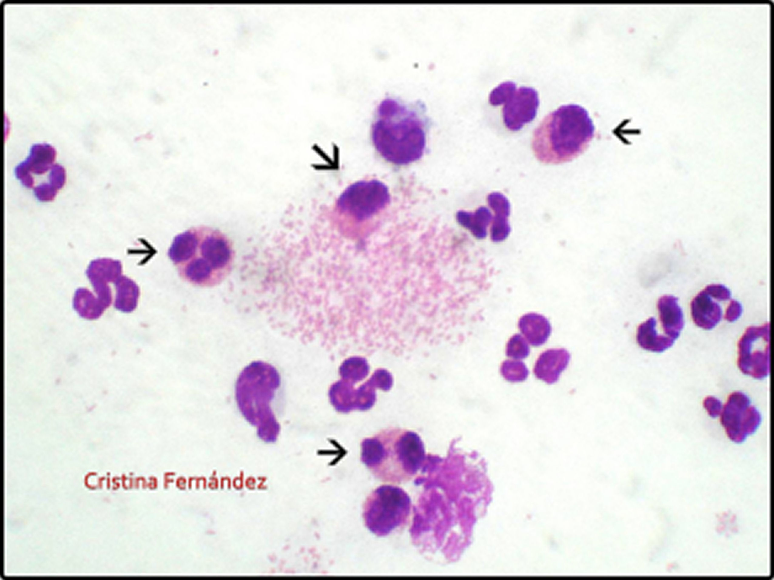 Conjuntivitis eosinofílica felina