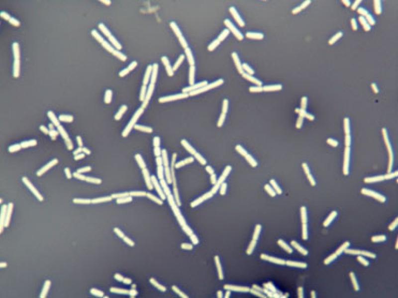 Bacillus cereus. Tinción negativa