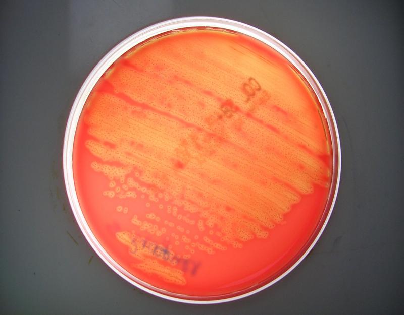 Streptococcus pyogenes. Crecimiento en placa sobre medio sólido.