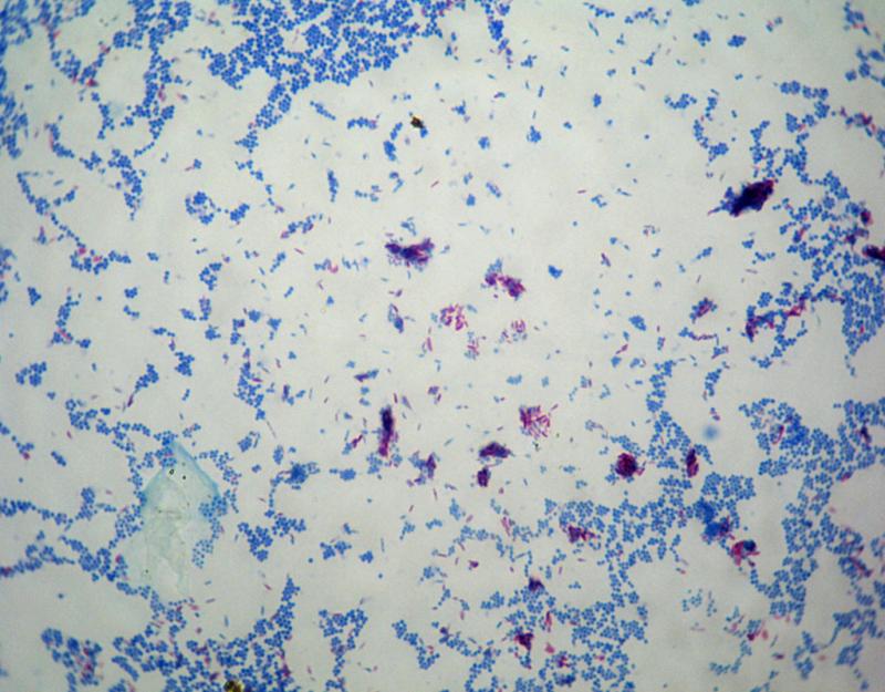 Mycobacterium phlei y Staphylococcus aureus: Tinción de ácido-alcohol resistencia