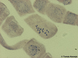 Cromosomas de almendro Prunus dulcis (2n = 16)