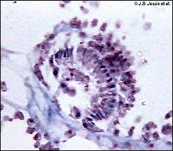 Esponja siconoide (desarrollo embrionario)