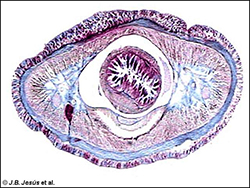 Sección histológica transversal de un Hoplonemertino