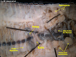 Anatomía interna de un Oligoqueto