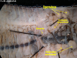 Anatomía interna de un Oligoqueto