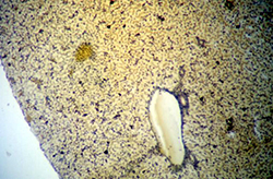 Hígado trabecular de anfibio