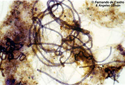 Microorganismo filamentoso