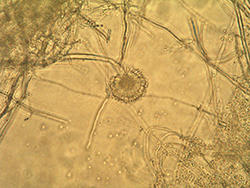 Micrografía de Aspergillus ochraceus