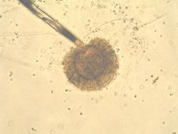 Micrografía de Aspergillus tubingensis