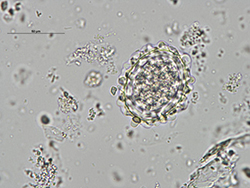 Huevo fértil de Ascaris lumbricoides