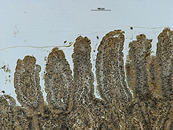 Sección histológica del epitelio intestinal de gato infectado con Toxoplasma gondii.