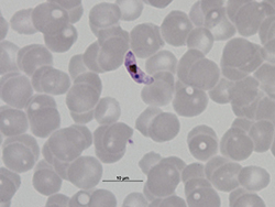 Macrogametocito de Plasmodium falciparum.
