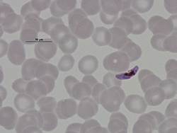 Microgametocito de Plasmodium falciparum.