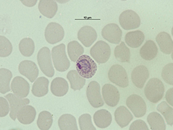 Trofozoíto de Plasmodium ovale.