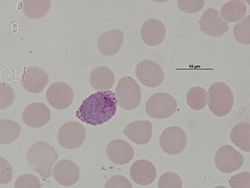 Macrogametocito de Plasmodium vivax.