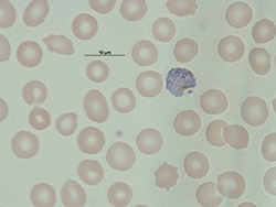 Microgametocito de Plasmodium vivax.