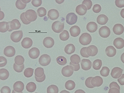 Trofozoíto de Plasmodium malariae.