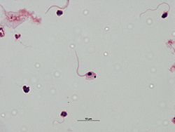 Esferomastigoto  de Trypanosoma cruzi .