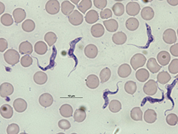Tripomastigotos  de Trypanosoma gambiense .