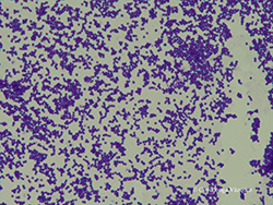 Staphylococcus aureus. Tinción simple