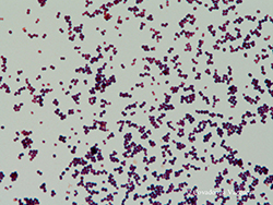 Tinción Gram. Micrococcus luteus