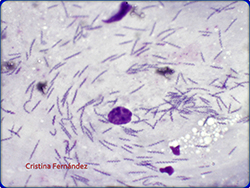 Gastritis por Helicobacter pilori en estómago de un perro