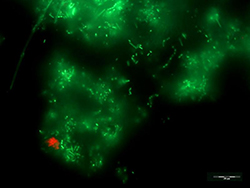 Comunidades de bacterias. Viabilidad celular