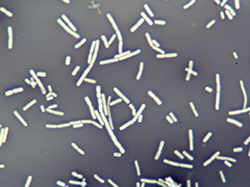 Bacillus cereus. Tinción negativa