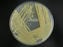 Micrococcus luteus. Aislamiento en medio sólido.