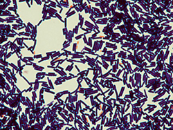 Bacillus cereus. Tinción de Gram.